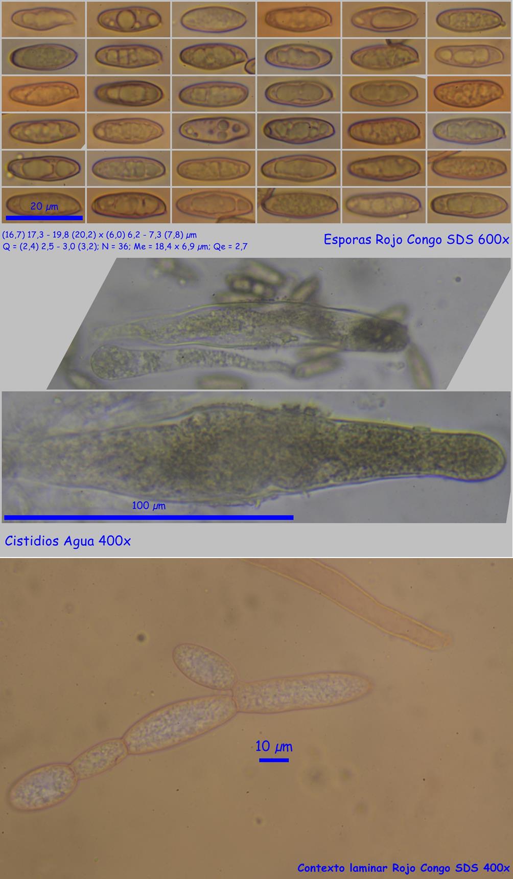Gomphidius maculatus esporas y cistidios