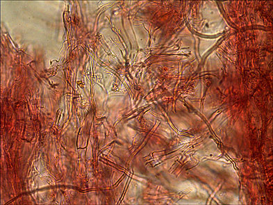 Pilleipelis con Rojo Congo 400X Pleurotus opuntiae