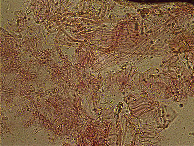 Trama laminar con Rojo Congo 400X Pleurotus opuntiae